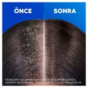 Head&Shoulders Şampuan Saç Dökülmesine Karşı Kafein Etkili 330 ml