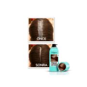 L'Oreal Paris Magic Retouch Kahverengi Beyaz Kapatıcı Sprey 75 ml