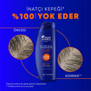Head & Shoulders Şampuan Clinical Strength Dry Scalp Rescue 400 ml