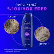 Head & Shoulders Şampuan Clinical Strength Advanced Oil Control 400 ml