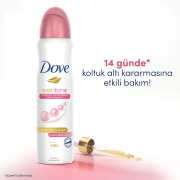 Dove Kadın Sprey Deodorant Eventone Kalendula Özü 150 ml